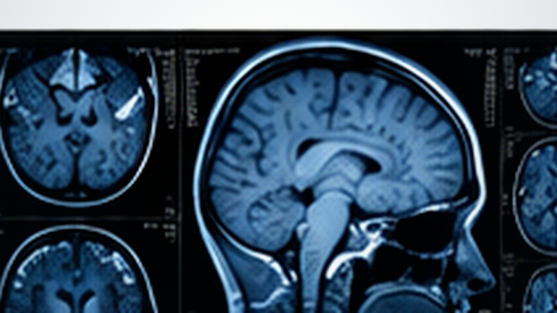 How the Human Brain Works: Structure, Networks and Function